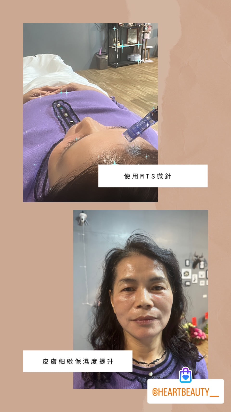 S__13328429